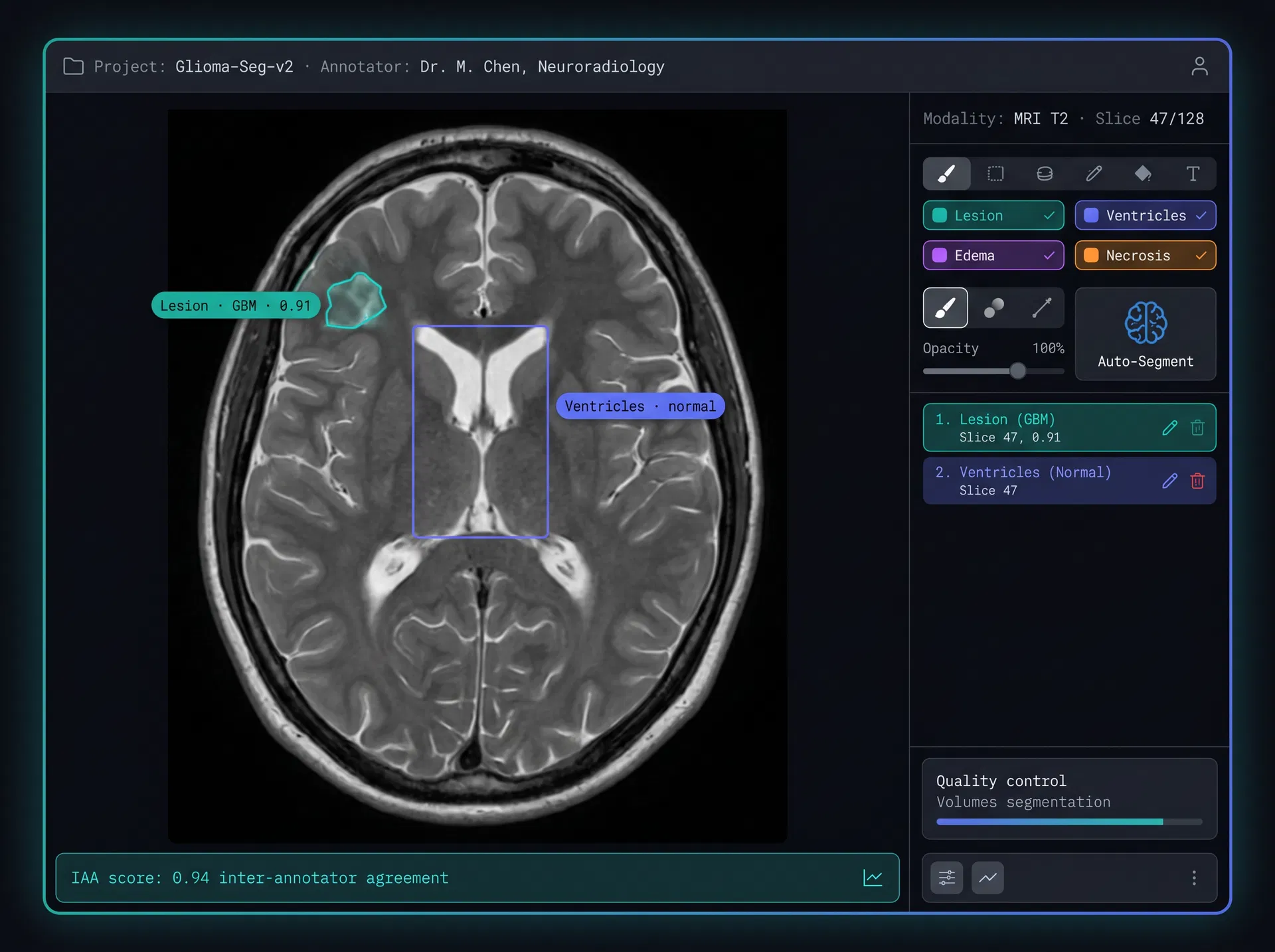 Specialist Clinical Annotation